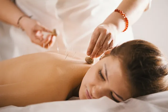 acupuntura